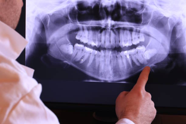 Best Emergency Root Canal Treatment in Ore City, TX